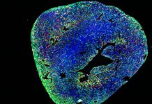 Curing A Broken Heart: A Public Event On Innovative Therapies To Fight Cardiovascular Diseases